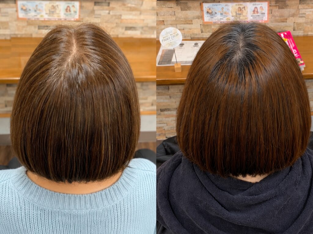 フォギーカラー ビフォーアフター 施術事例2
